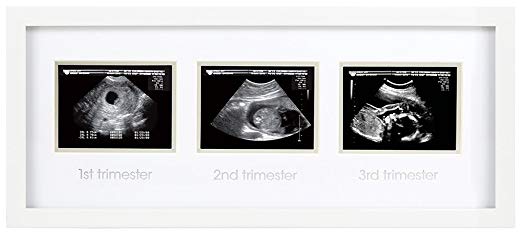 Pearhead Triple Sonogram Pregnancy Keepsake Frame, Watch Baby Grow Through all Three Trimesters - Great Gift For Expecting Parents, White