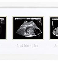 Pearhead Triple Sonogram Pregnancy Keepsake Frame, Watch Baby Grow Through all Three Trimesters - Great Gift For Expecting Parents, White
